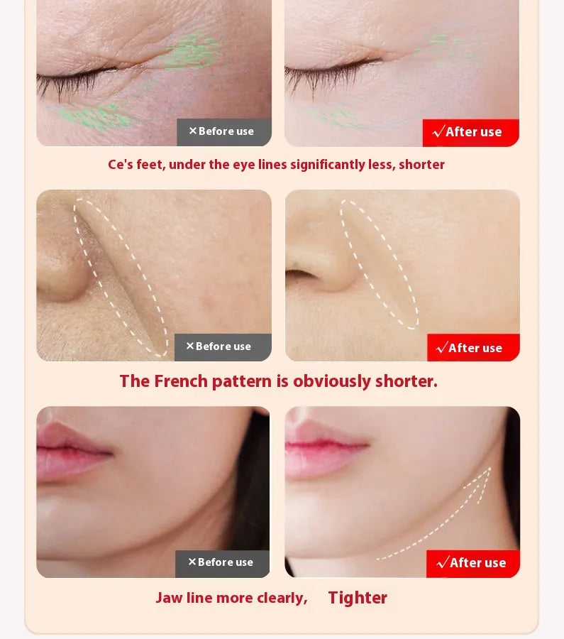 LED Res Light Therapy Facial Wand