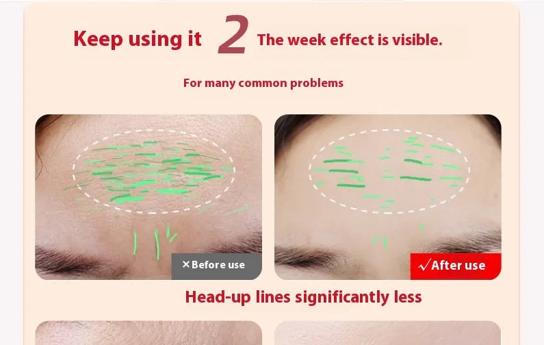 LED Res Light Therapy Facial Wand