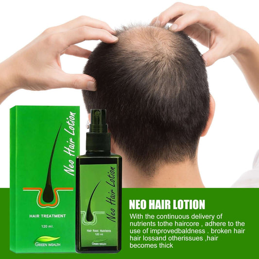 Hair Care Growth Lotion Spray: A Comprehensive Review